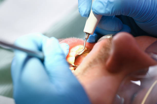 Best Emergency Dental Care for Sports Injuries in Latrobe, PA