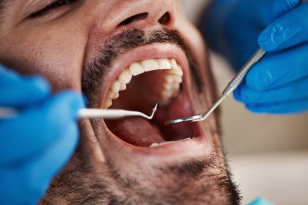 Best Dental Abscess Treatment in Latrobe, PA